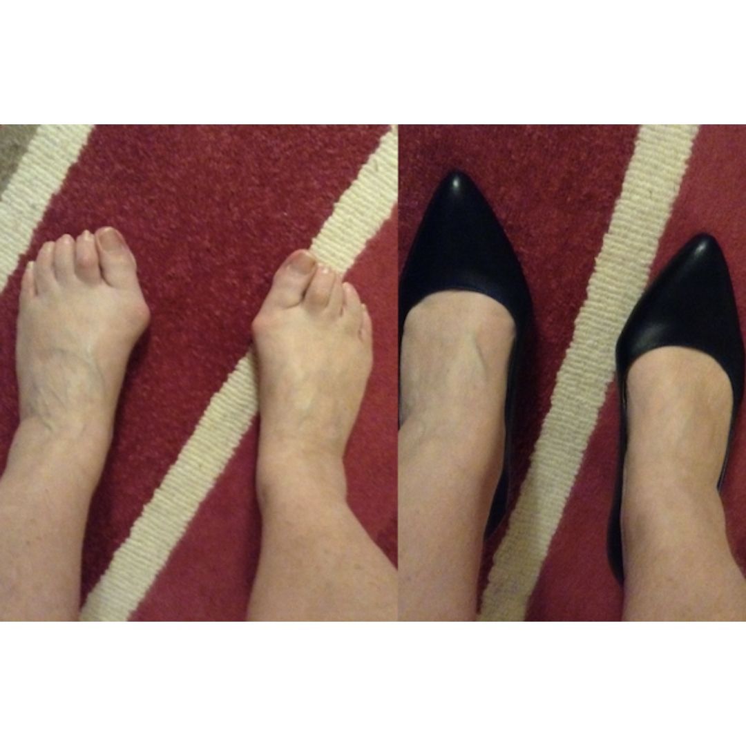 customer photo review of calla shoes