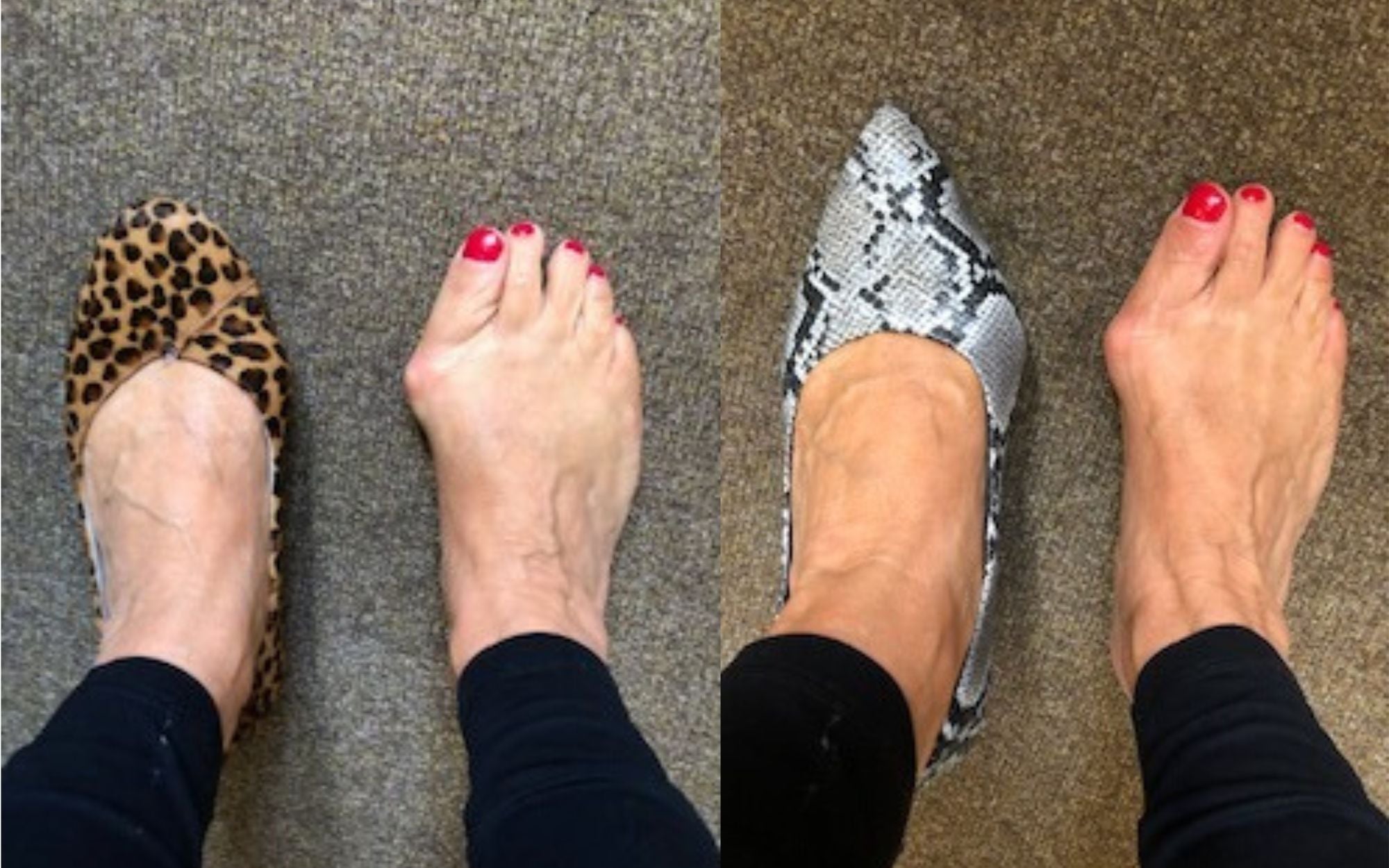 customer review of ava kitten heels and charlotte flats for bunions