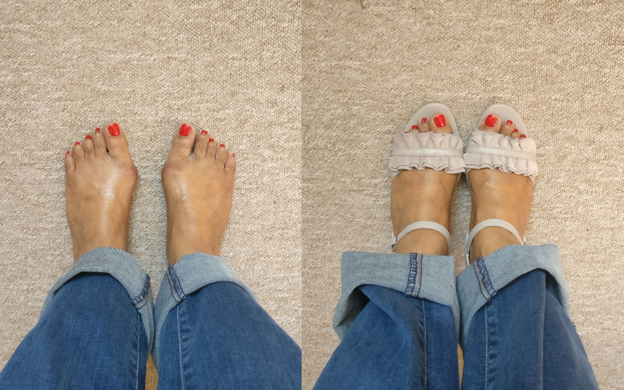 sandals for bunions customer reviews