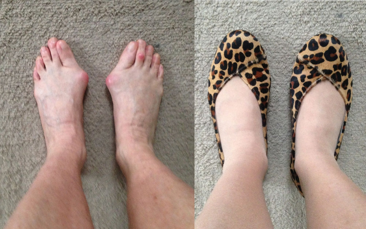 customer review of charlotte leopard suede flats for bunions and wide feet