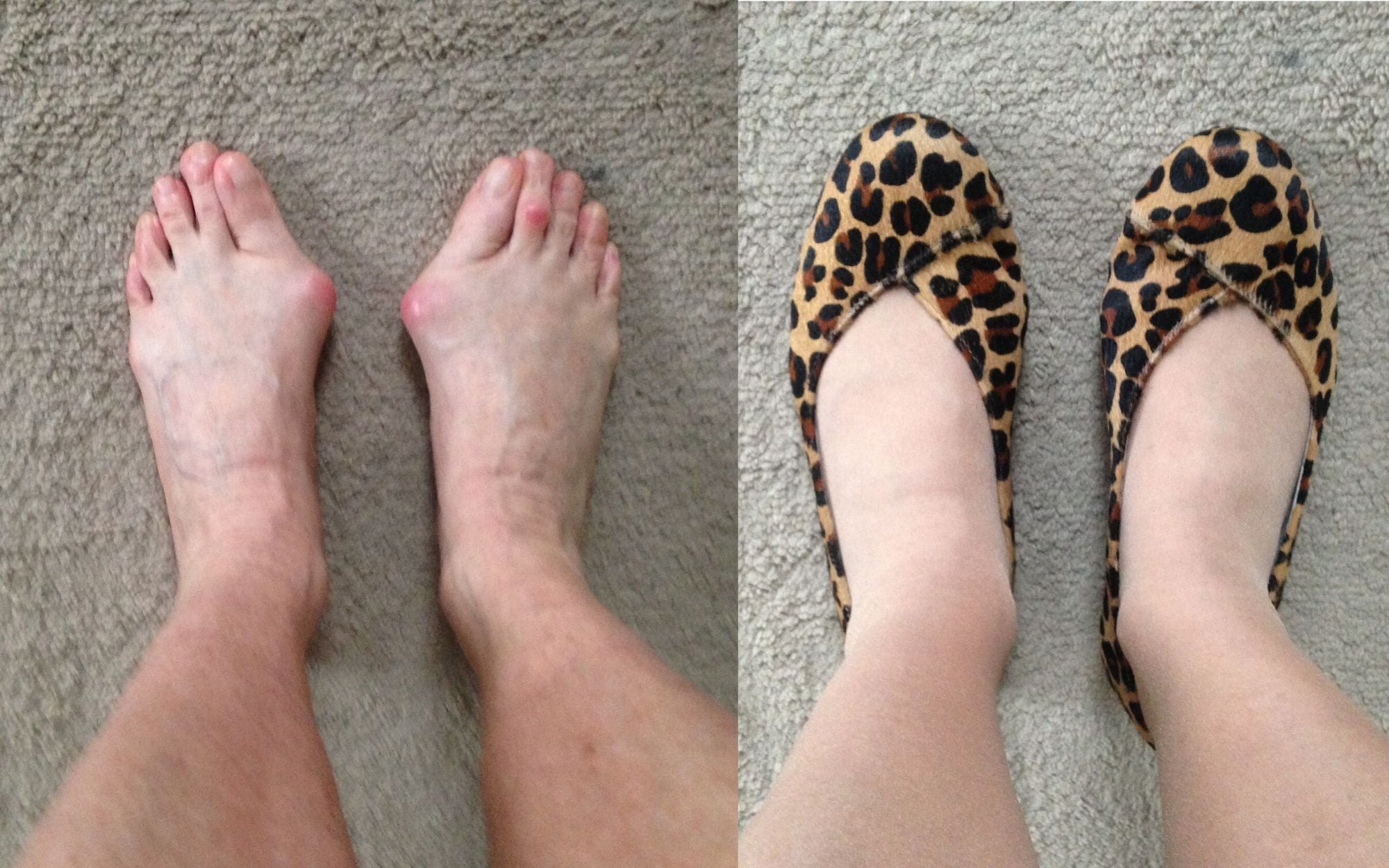 customer review of charlotte leopard suede flats for bunions and wide feet