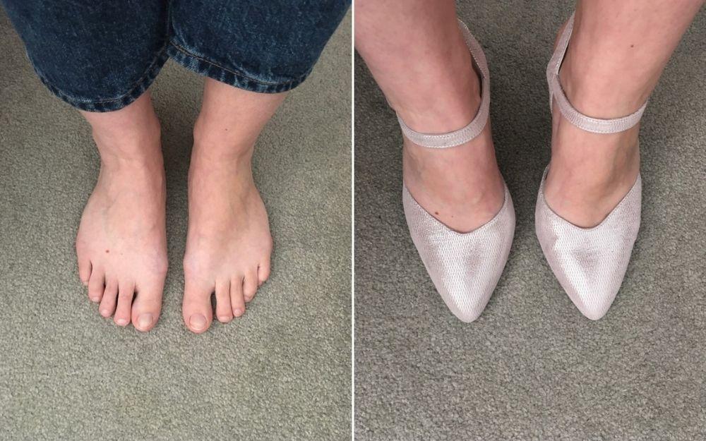 review of calla shoes for bunions by customer