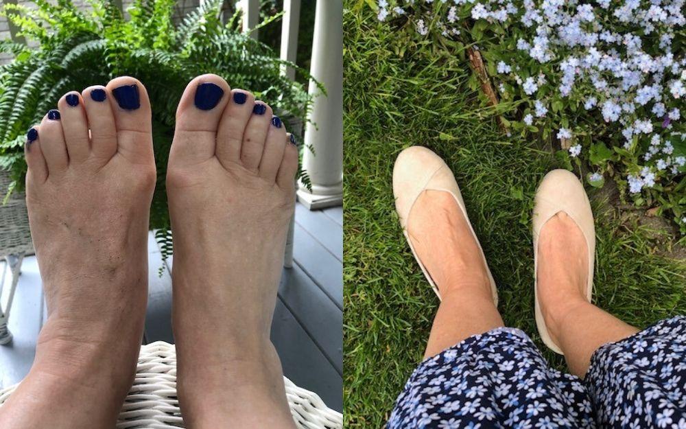 review of calla shoes for bunions by customer
