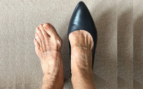 customer review of ava kitten heel for bunions by calla shoes
