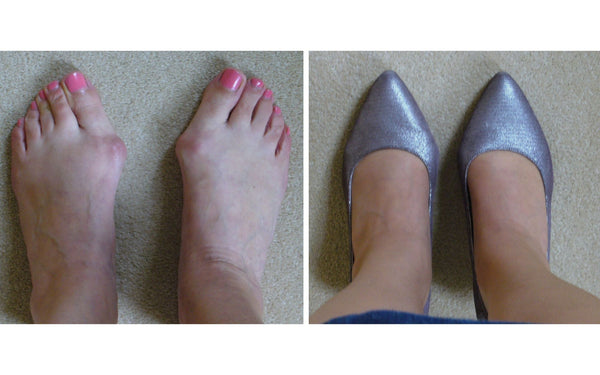 kitten heels for bunions by calla happy customer review