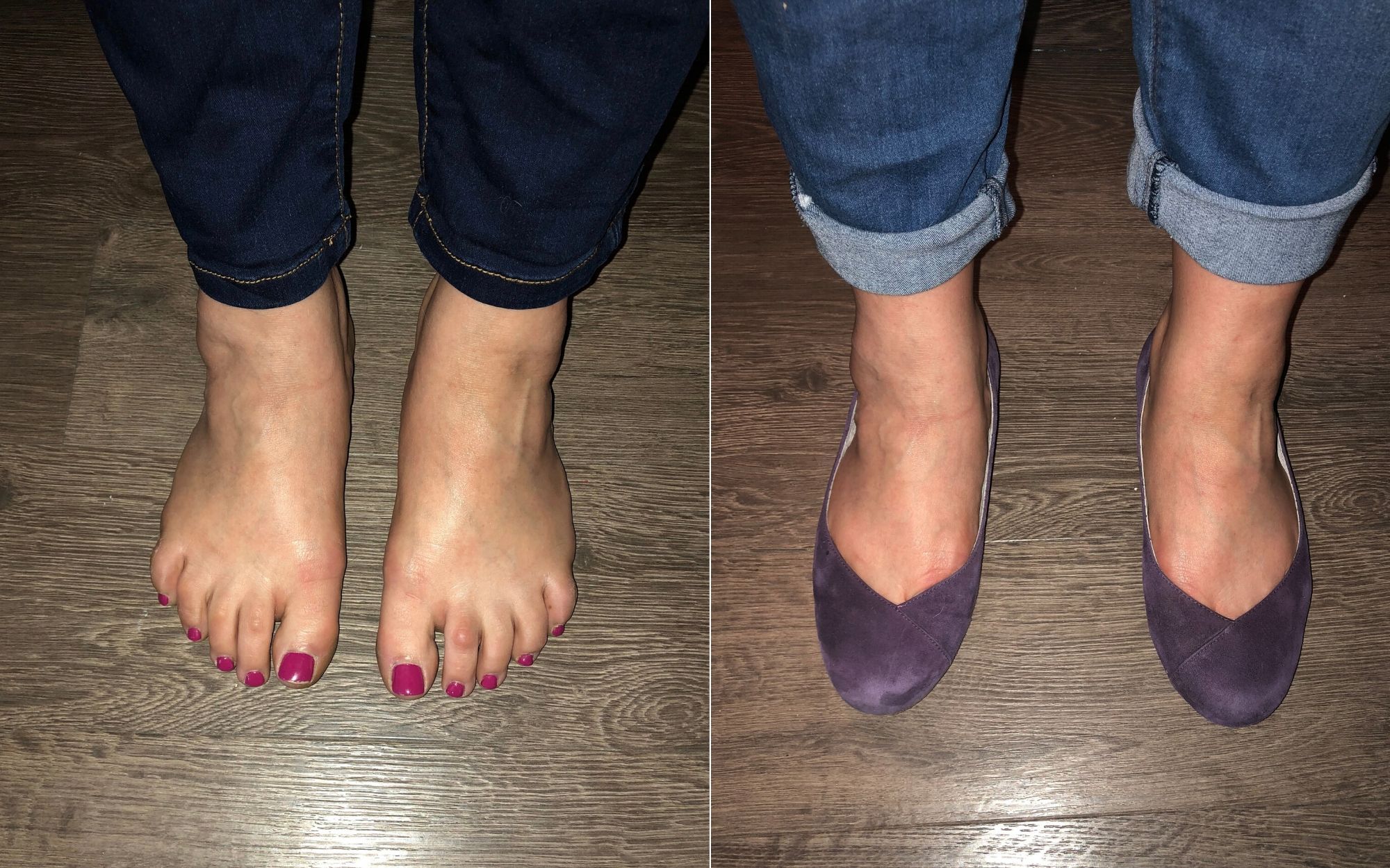 customer review of calla charlotte flat shoes for bunions and plantar fasciitis