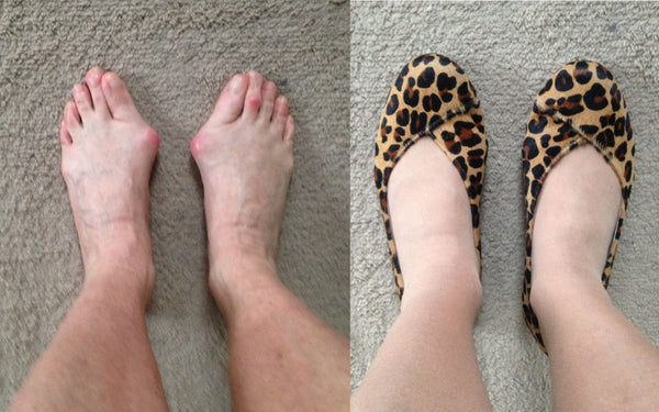 customer review of charlotte leopard suede flats for bunions and wide feet 