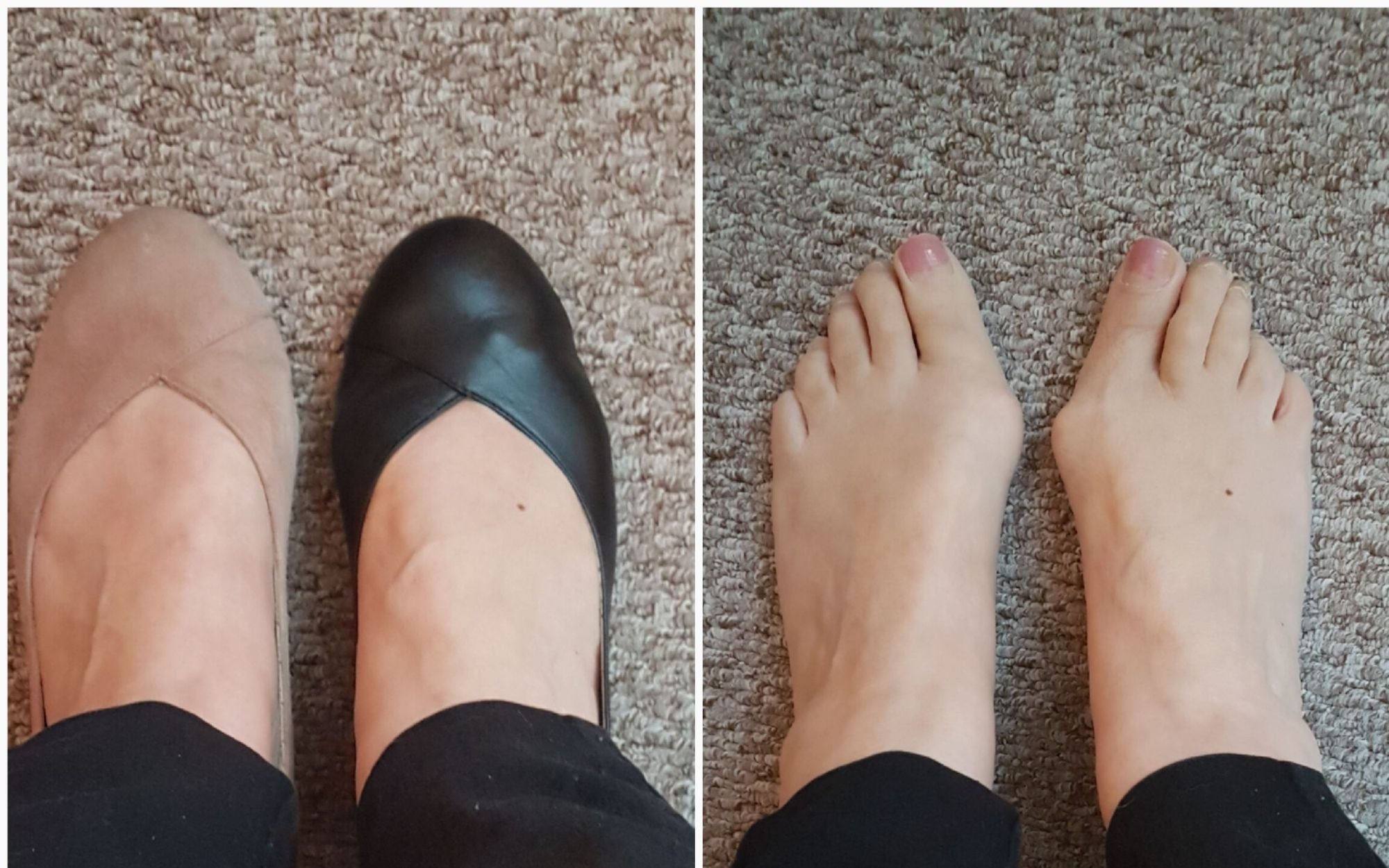 flat shoes for bunions customer review for calla shoes 