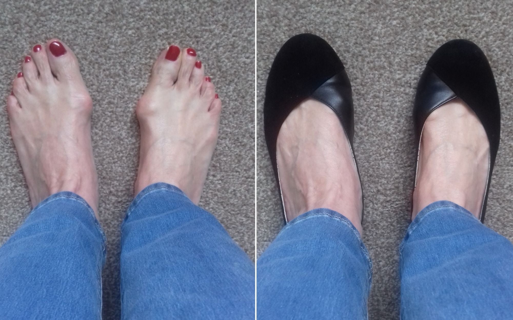 calla shoes customer review charlotte flat shoes for bunions 