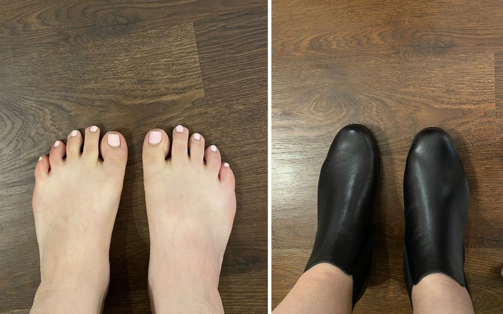 review of calla shoes for bunions by carol