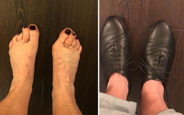 review of calla shoes for bunions by micki