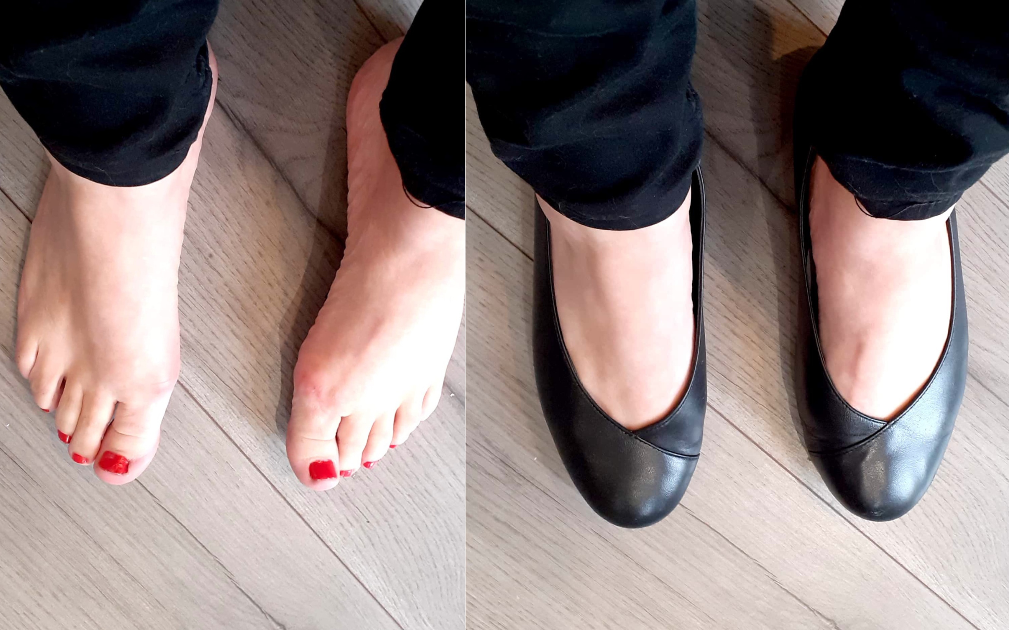 photo review of calla shoes for bunions