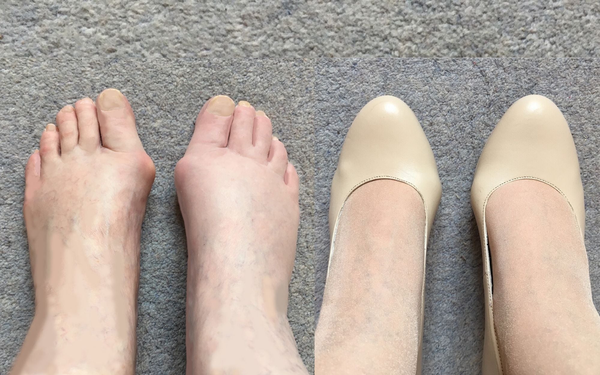 calla shoes for bunions sophia court shoe customer review