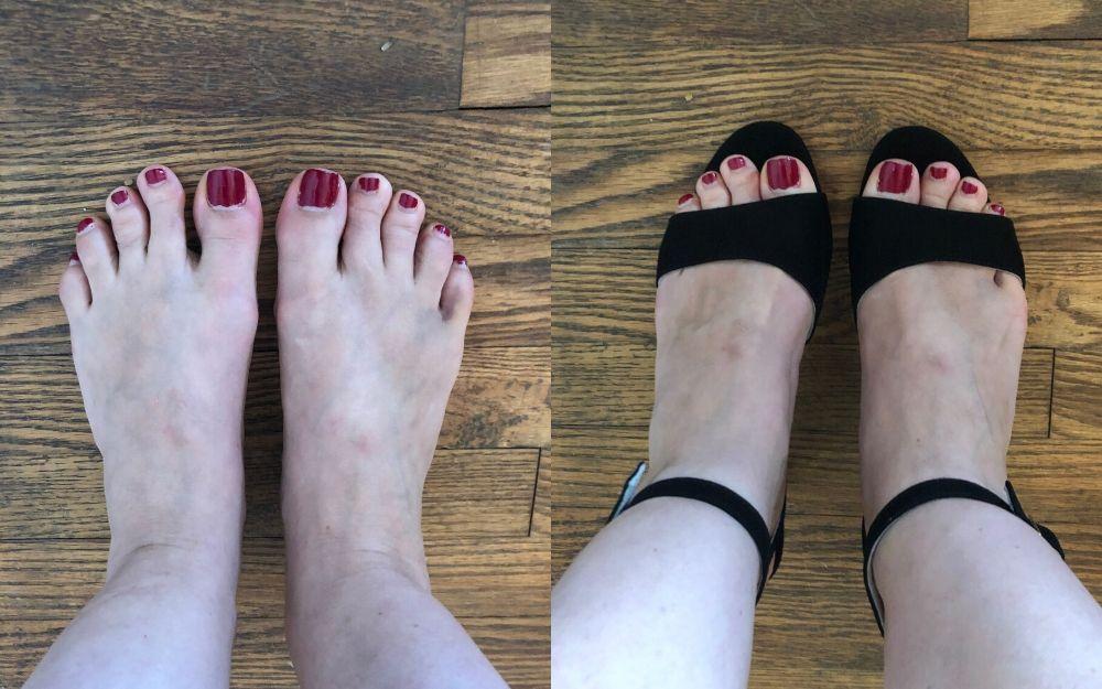 review of calla shoes for bunions