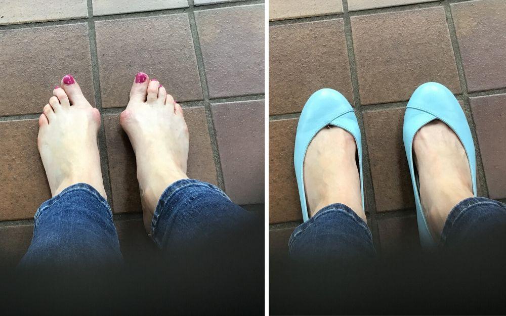 customer reviews calla flats for bunions