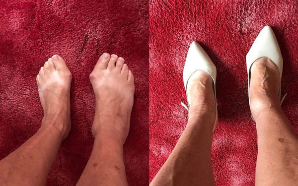 woman with bunions wears cream shoes