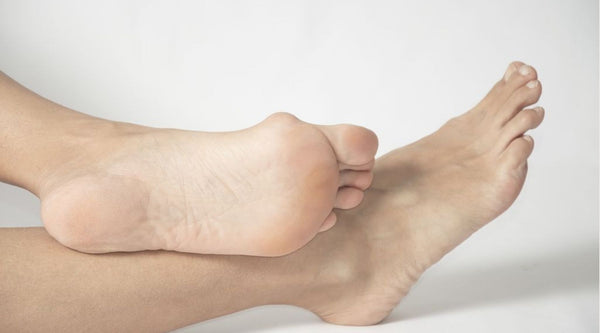 stop bunions from forming on your feet by podiatrist
