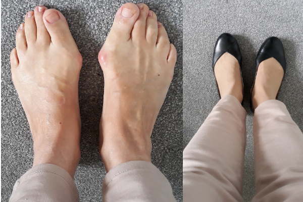 charlotte black leather flats for bunions customer reviews